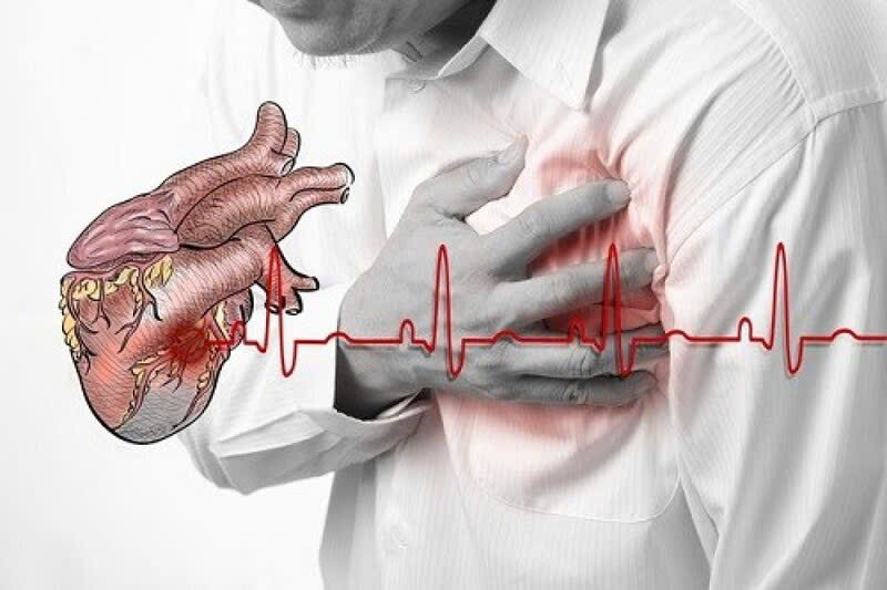 NHỒI MÁU CƠ TIM CẤP: NHẬN BIẾT SỚM ĐỂ KHÔNG BỎ LỠ
